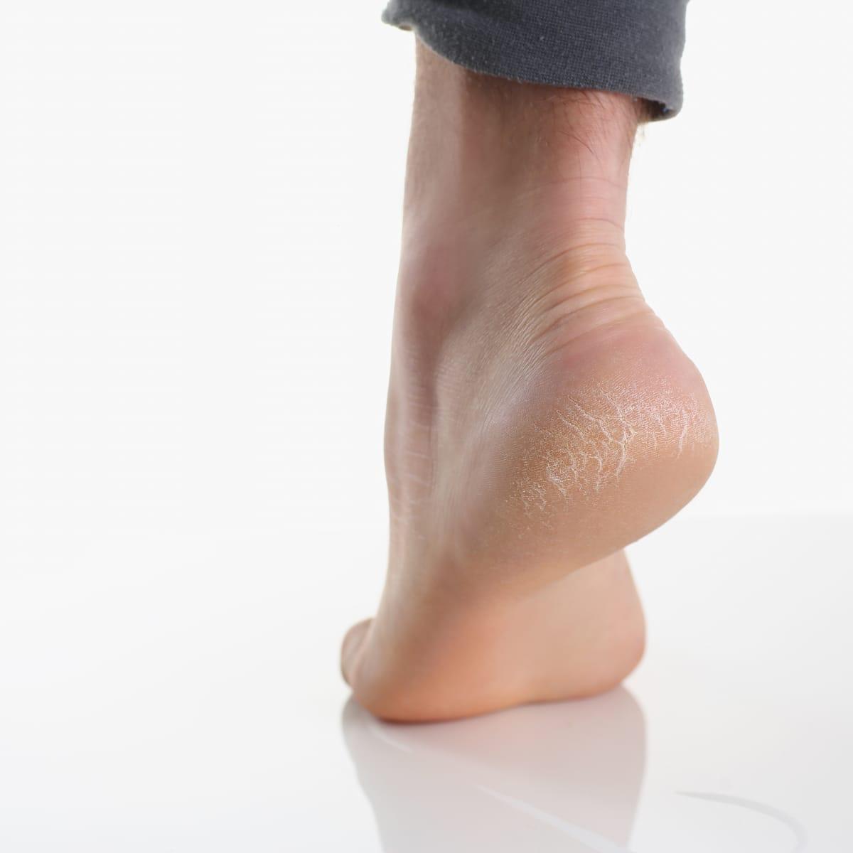 A bare foot rising up onto the toes with the heel lifted