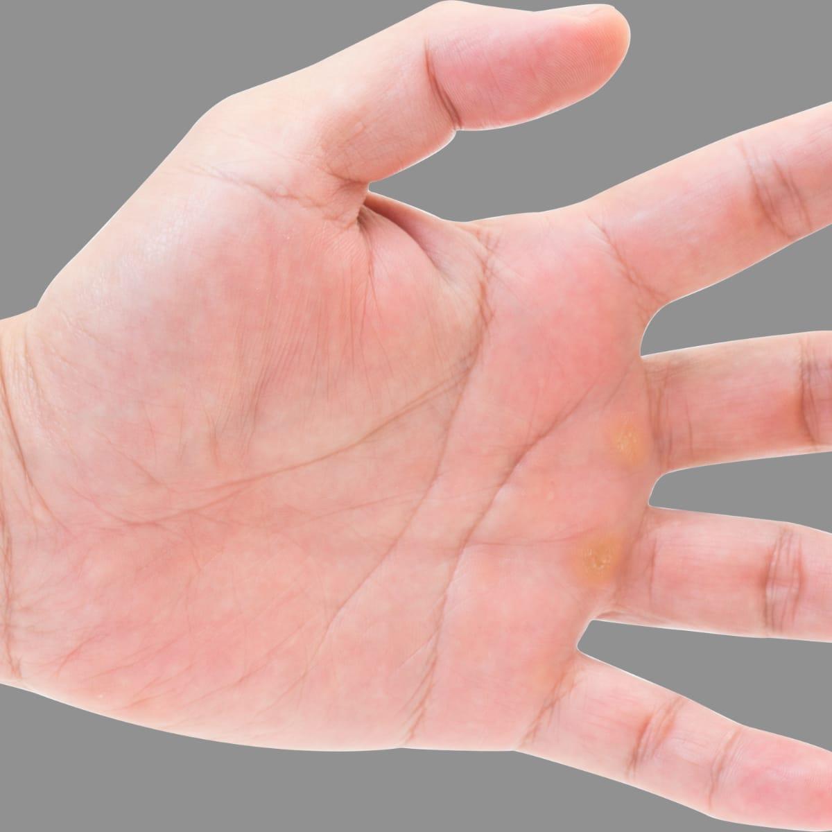 An open palm, used as a guide for a protein portion